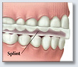 Periodontal Disease Treatment Bite Correction